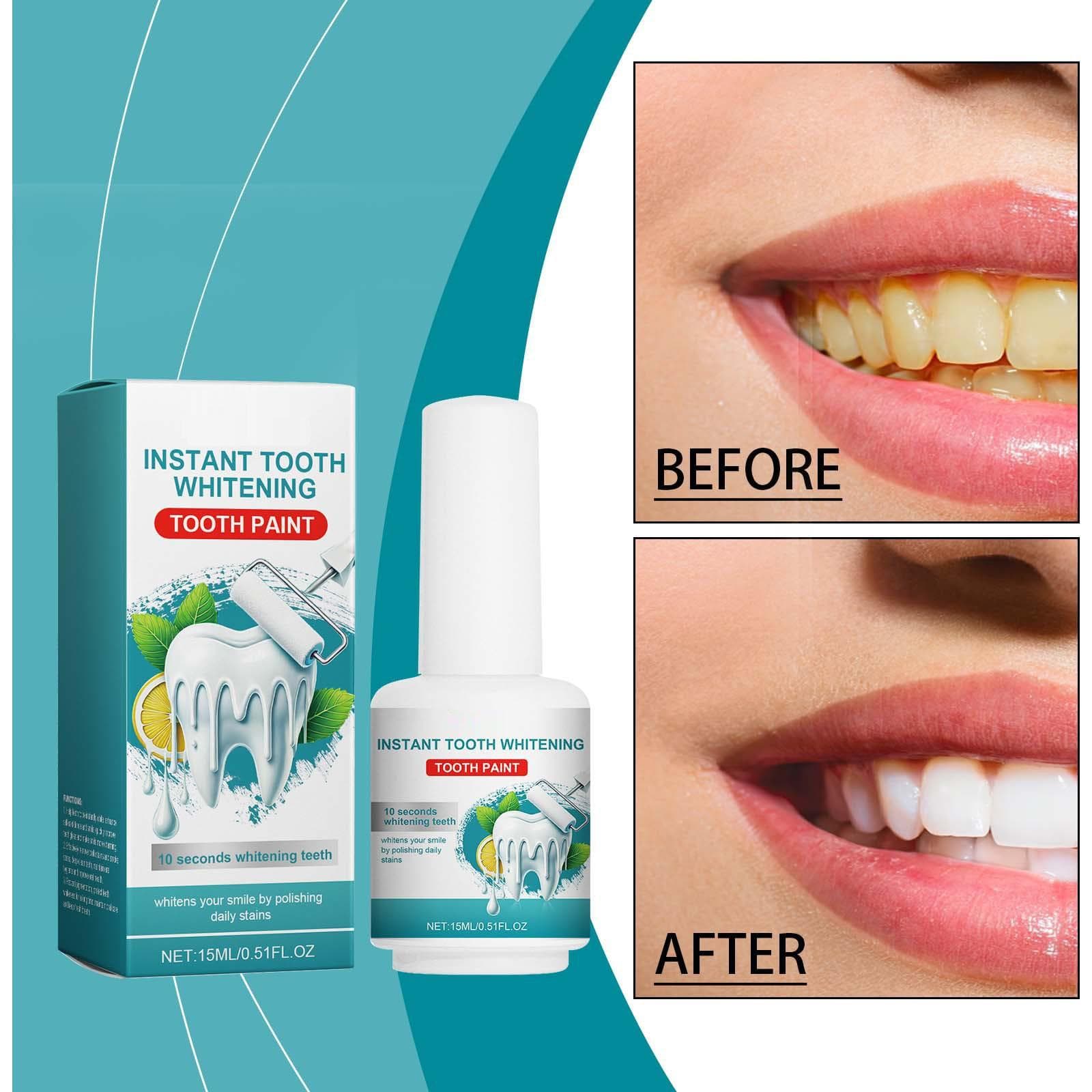 Teeth Whitening Paint, Instant Teeth Whitening Paint, Teeth Whitening Pen 15ml